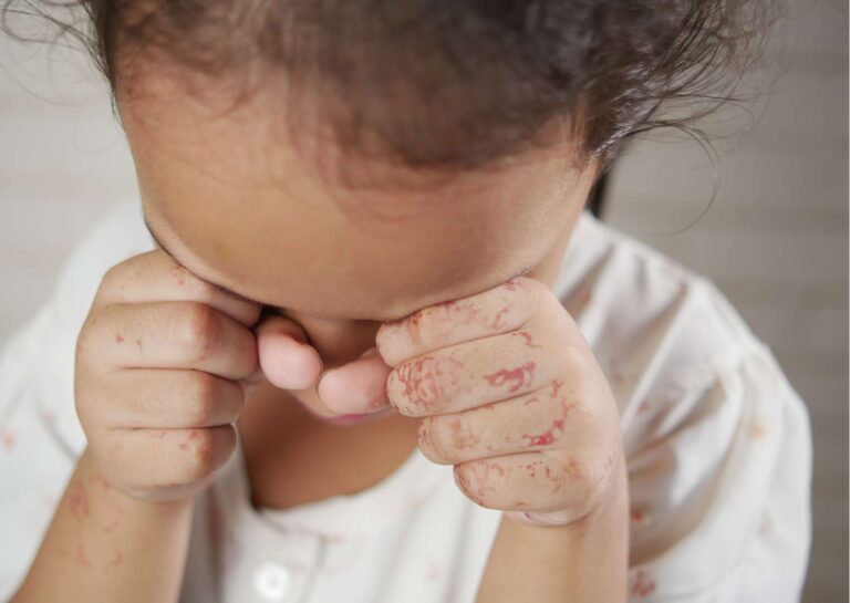 Understanding Child Exploitation